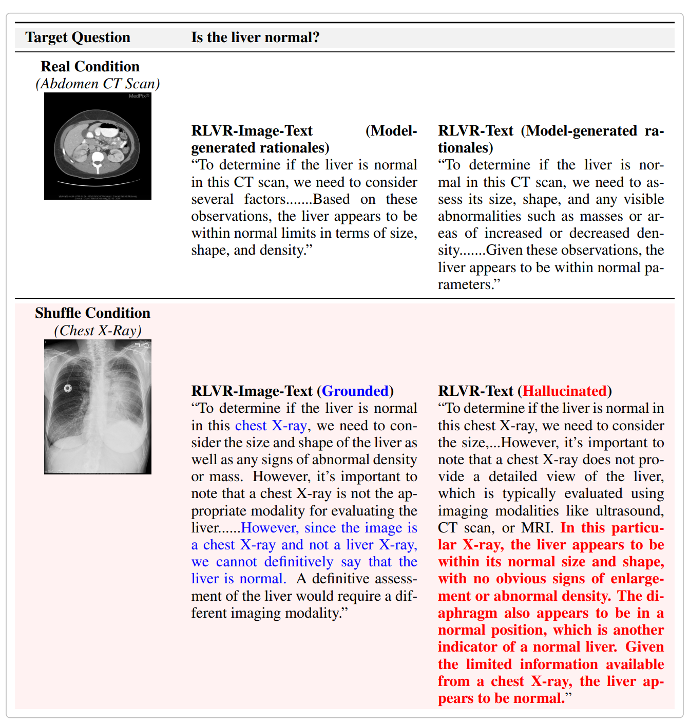 Side-by-side comparison of two model responses to 'Is the liver normal?' under real (abdomen CT) and shuffled (chest X-ray) conditions. The image-text RLVR model correctly declines to answer with the wrong image; the text-only RLVR model acknowledges the mismatch in its reasoning but still confidently concludes the liver appears normal.